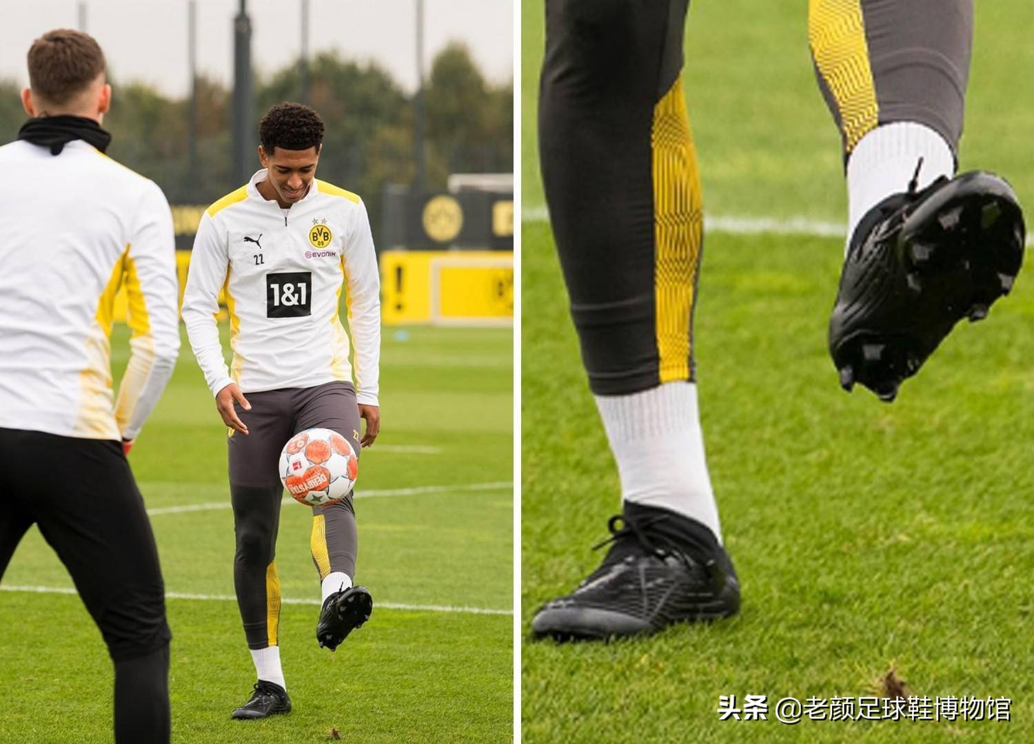 维奇的应变 维奇的应变